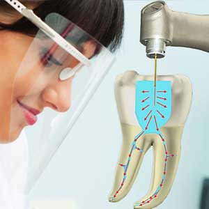 Laser Dental Treatments