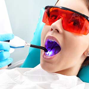 Laser Dental Treatments