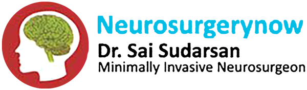 Eye hospital in Chennai