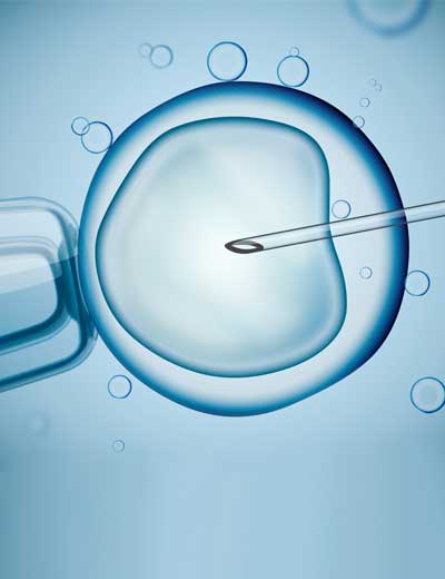 infertility