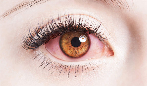 vitreo Retina